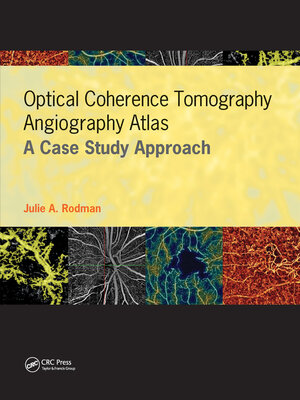 cover image of Optical Coherence Tomography Angiography Atlas